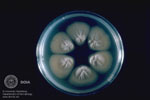 Trichosporon cutaneum