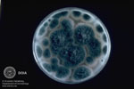 Aspergillus fumigatus