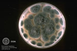 Aspergillus fumigatus